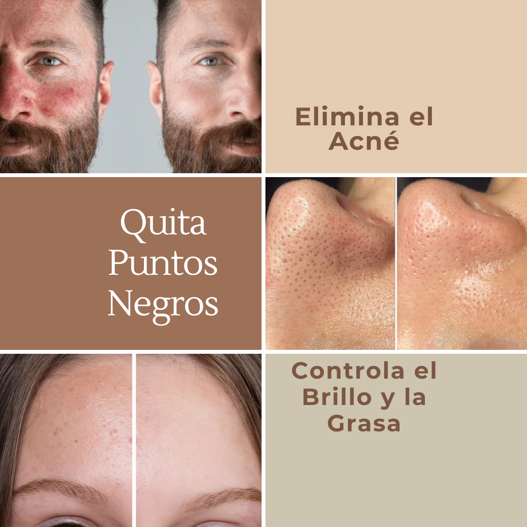 Limpiador Facial - PerfectSkin™
